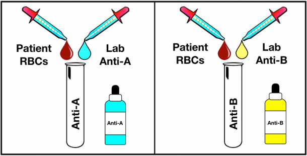 ABO Blood Group System Testing - A Primer - Blood Bank Guy