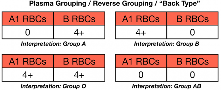 ABO Blood Group System Testing - A Primer - Blood Bank Guy